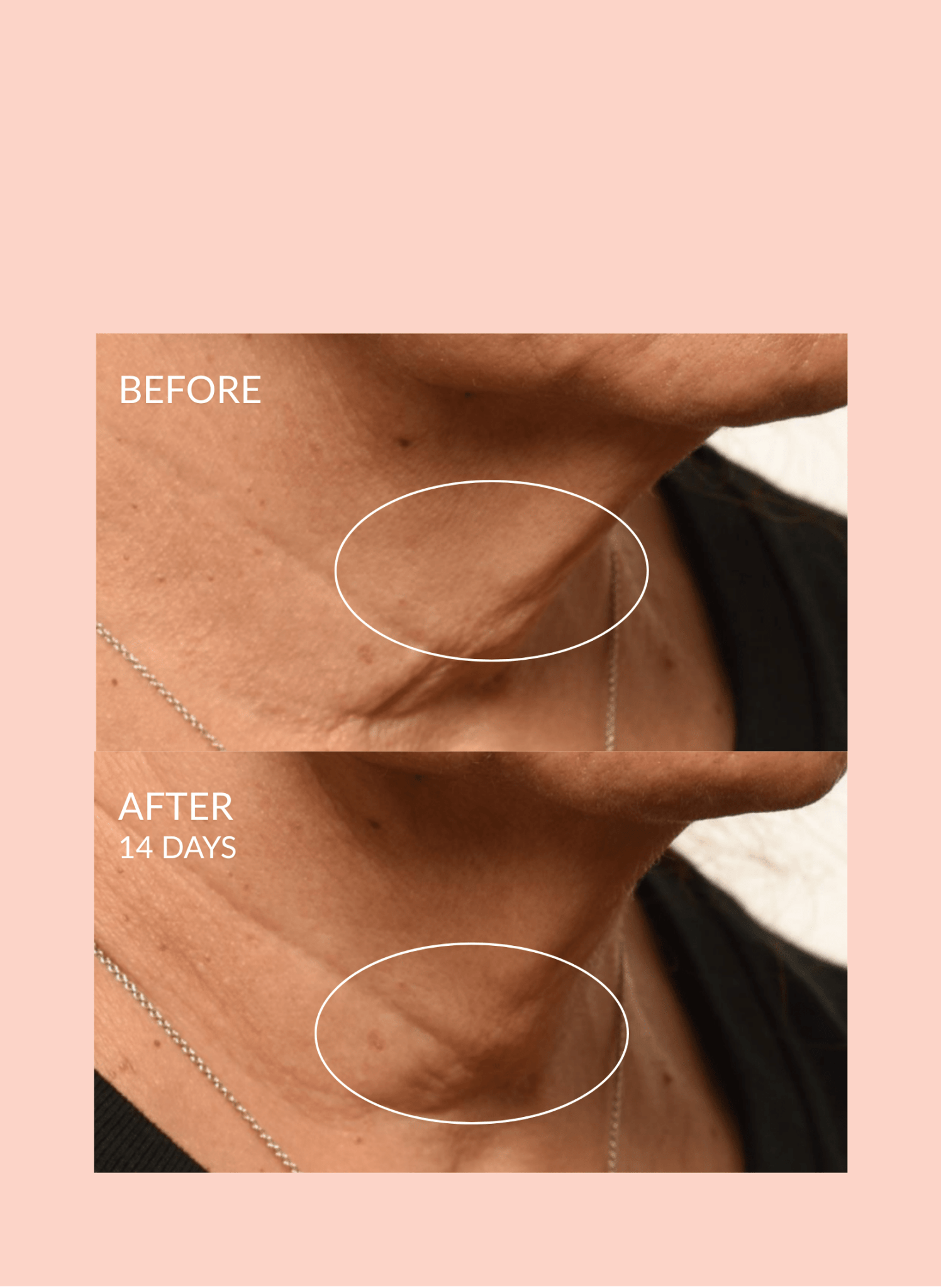 Theorem Serum Boost